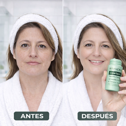 “Recupera la confianza en tu piel sin filtros”